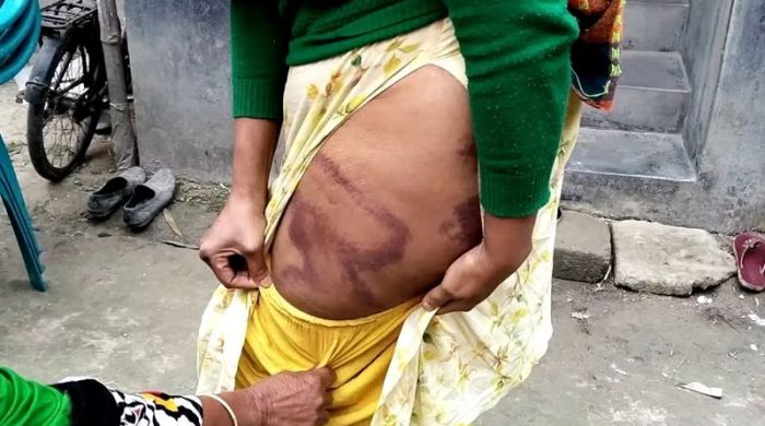 ঝিনাইগাতীতে জমি বিরোধকে কেন্দ্র করে হামলা ও লুটপাট: নারীসহ ৩ জন জখম, আদালতে মামলা